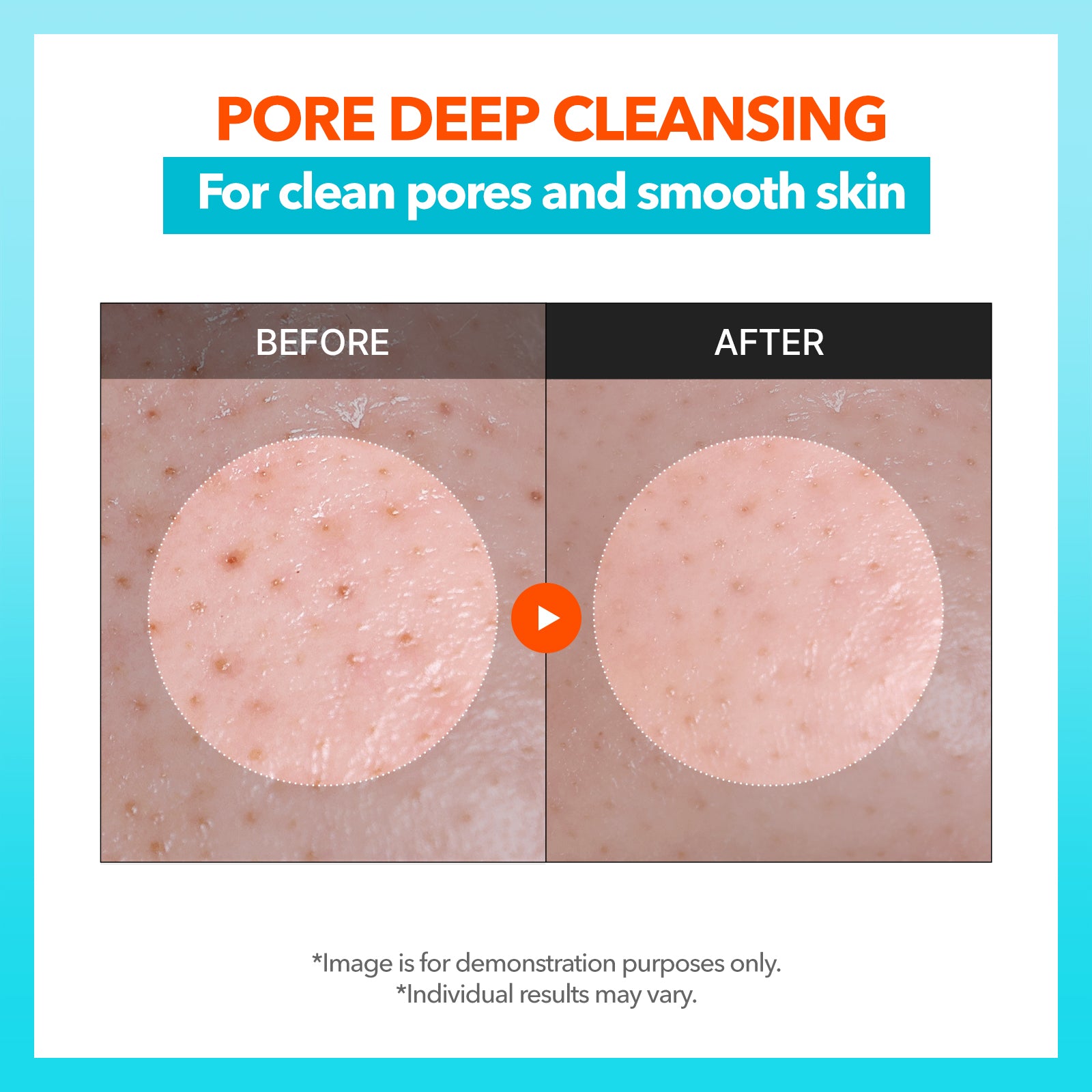 PHA Enzyme Pore Cleansing Oil
