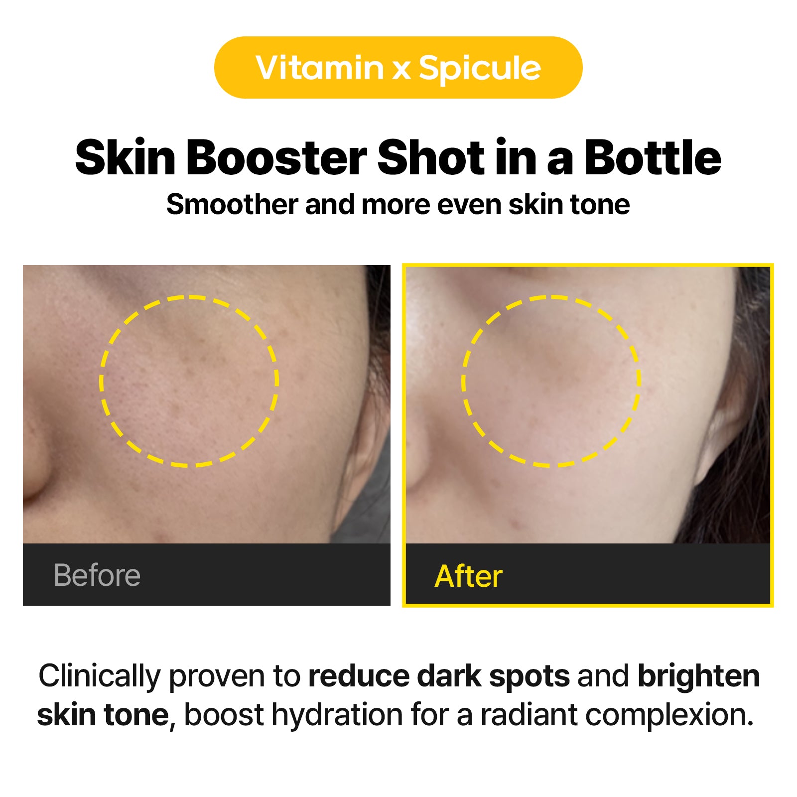 Toning C Vita Shot Ampoule