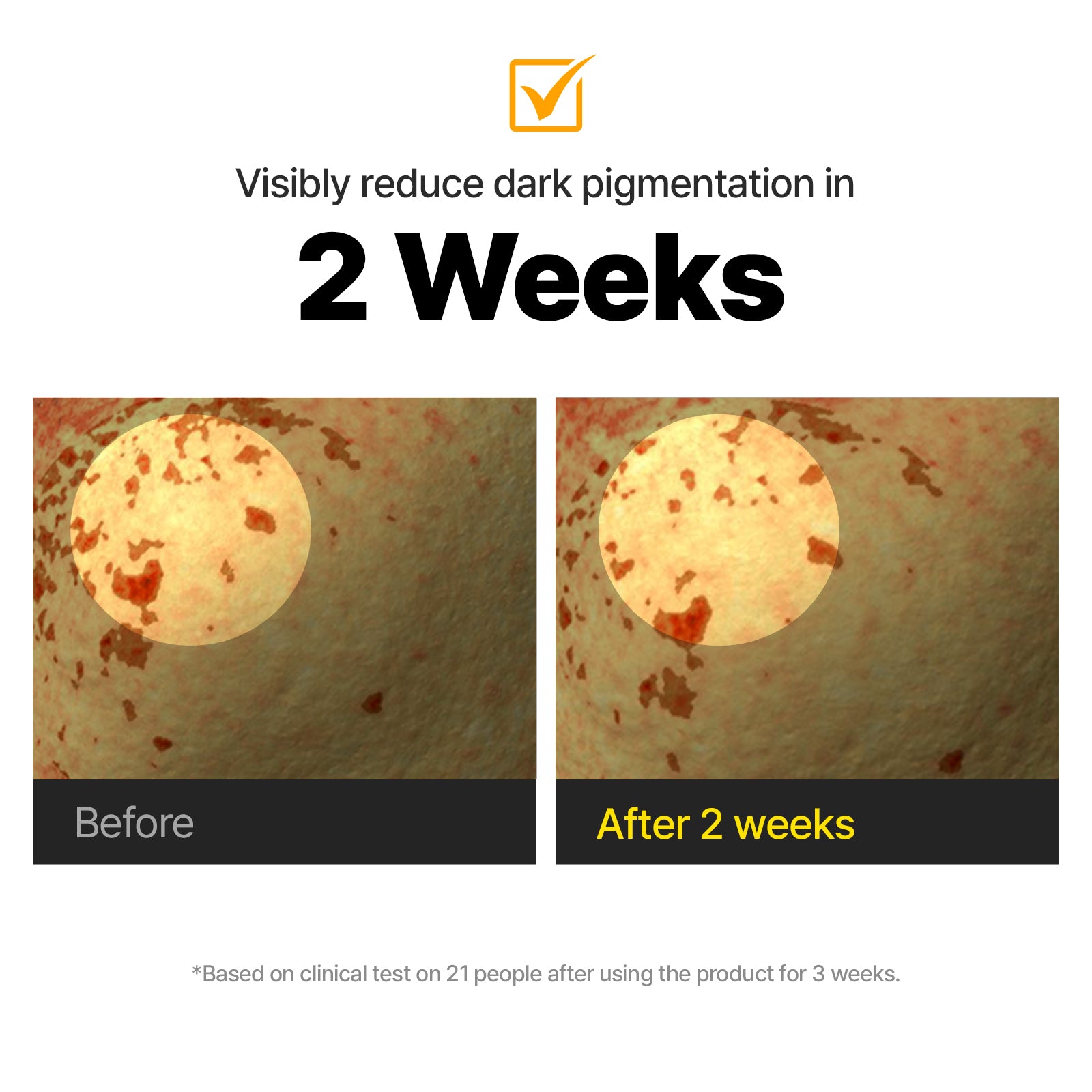 Dark Spot Eraser Duo