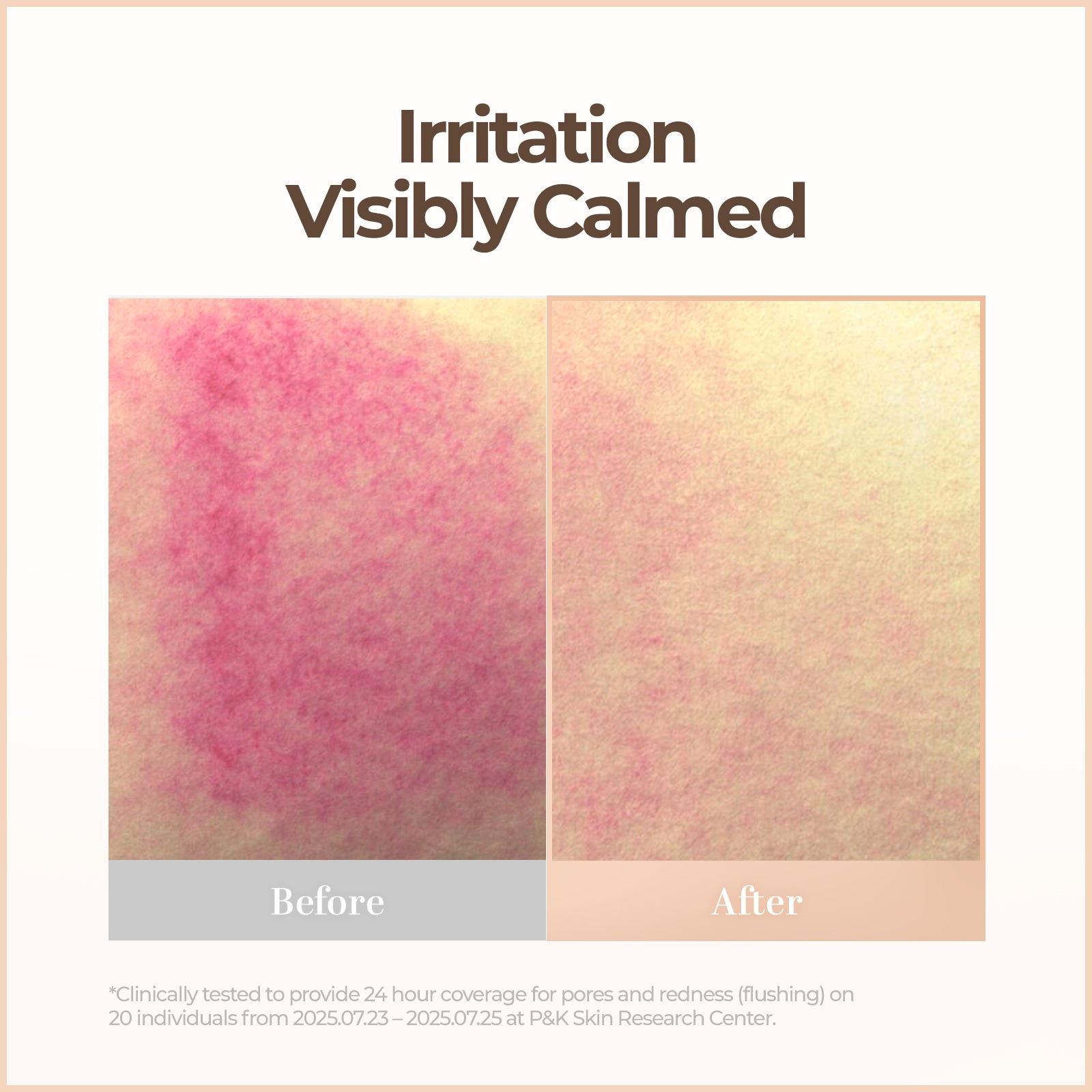 Skin Blemish Balm Intensive (Tinted Moisturizer BB Cream) - No.21 New Ver.